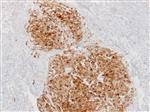 3740B | Control Slides:Immunopathology; S-100